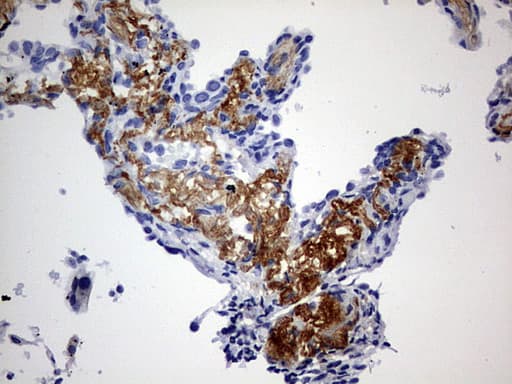 Monoclonal Mouse anti-Human RIPK3 / RIP3 Antibody (clone OTI2F12, aa233-518, IHC, WB)