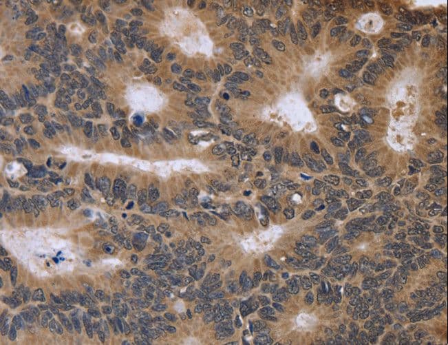 FGFR1OP2 Antibody