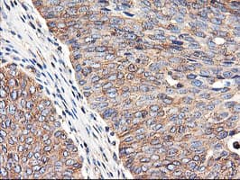 TUBAL3 Antibody (clone OTI1C2)
