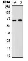 Polyclonal Rabbit anti-Human DDX5 Antibody (C-Terminus, IF, WB)