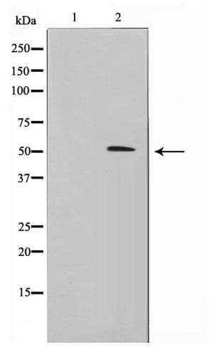 FKRP Antibody