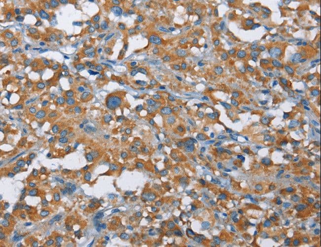 Polyclonal Rabbit anti-Human KLF7 Antibody (IHC)