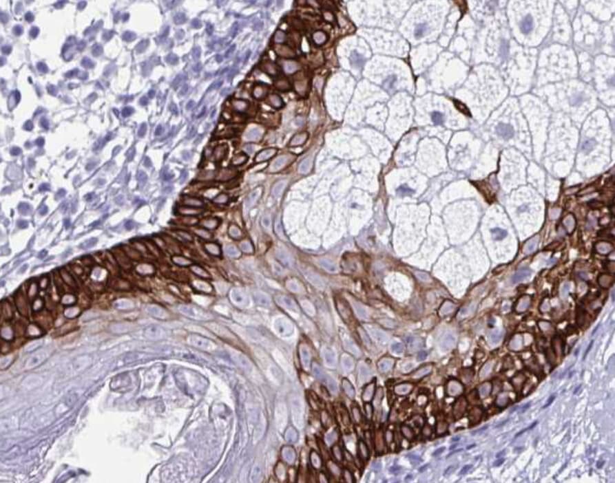Polyclonal Rabbit anti-Human KRT5 / CK5 / Cytokeratin 5 Antibody (IHC, IF, WB)