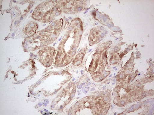 UBE2D2 / UBCH5B Antibody (clone OTI1D11)