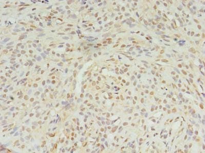 STK38L / NDR2 Antibody