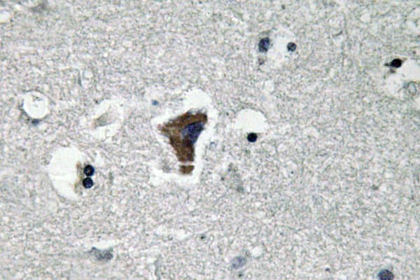 MYD88 Antibody (Val220)