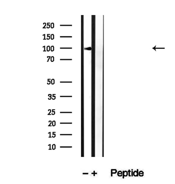 Polyclonal Rabbit anti-Human GPBB / PYGB Antibody (IHC, WB)