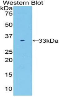 Alpha Fucosidase / FUCA1 Antibody (aa170-420)