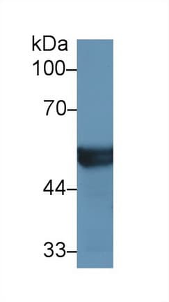 CYP2D6 Antibody (aa236-472)