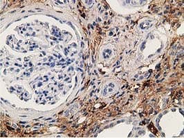 ADH2 / ADH1B Antibody (clone OTI5D7)