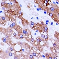 CTSL / Cathepsin L Antibody