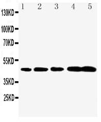 CASP1 / Caspase 1 Antibody (aa137-157)