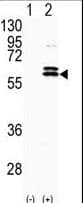 CDKL2 Antibody (aa226-255)