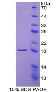 Human IL9 Protein (Recombinant His-T7)