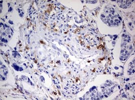Monoclonal Mouse anti-Human DOCK2 Antibody (clone OTI7G2, aa1544-1830, IHC, WB)