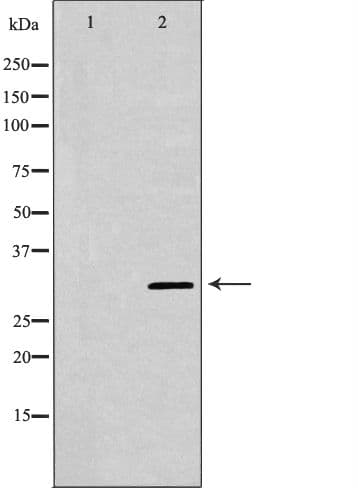KLK5 / Kallikrein 5 Antibody