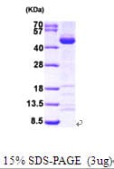 Human SAE1 Protein (Recombinant His)