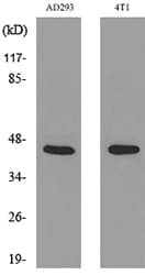 TNNT2 / CTNT Antibody