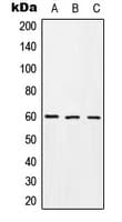 Polyclonal Rabbit anti-Human TROVE2 Antibody (Internal, WB)