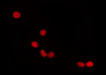 MAPK14 / p38 Antibody (phospho-Thr180)