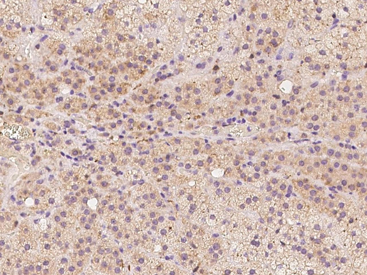 C1orf93 Antibody