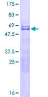 Human BIRC7 / Livin Protein (Recombinant GST)