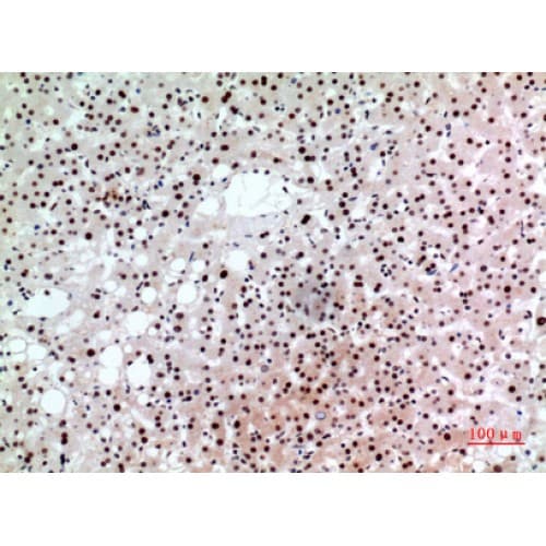Polyclonal Rabbit anti-Human BCL6 Antibody (271-320 aa, Internal, IHC, WB)