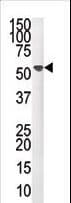 PPM1F Antibody (aa11-40)