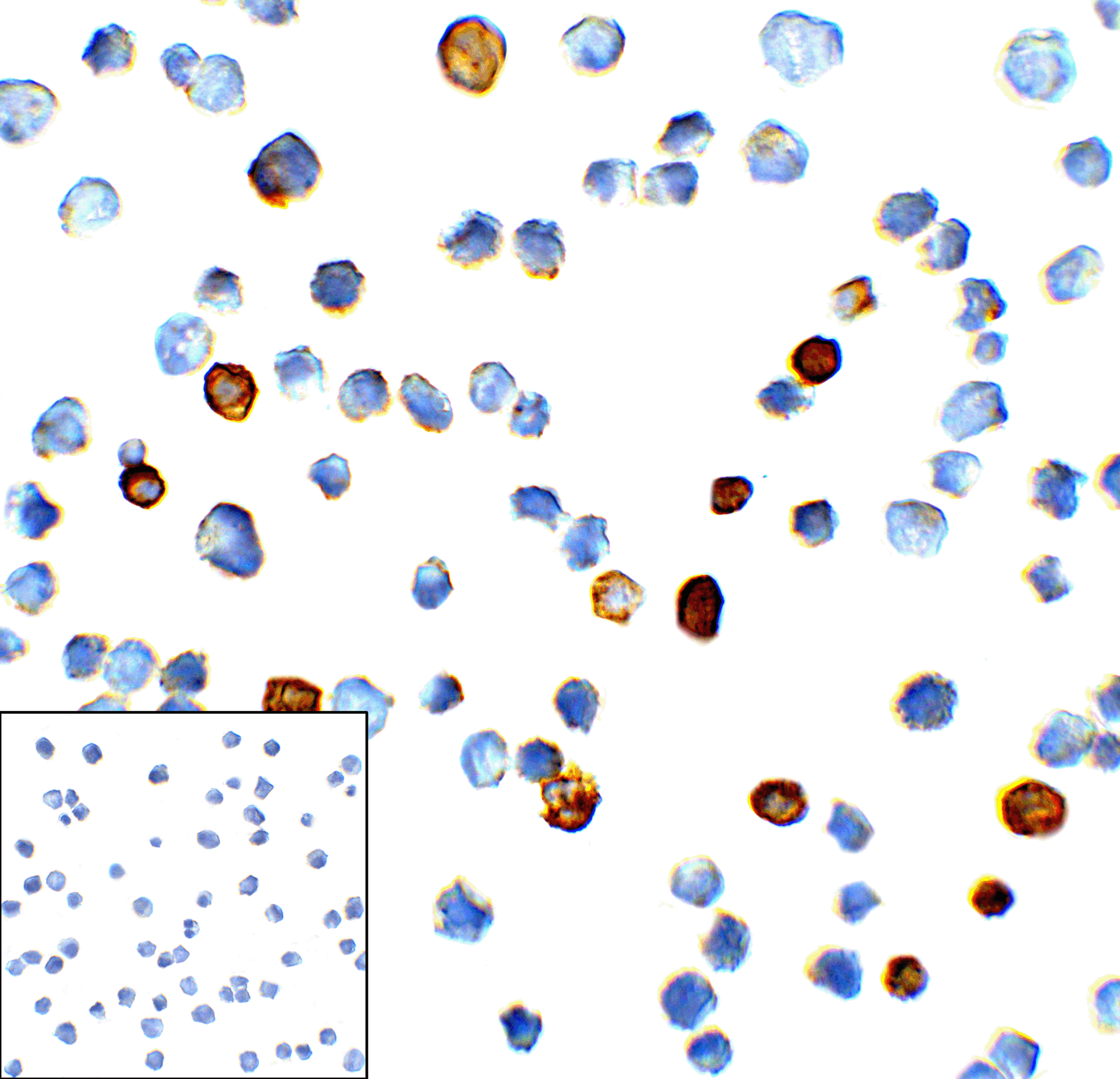 HAVCR2 / TIM-3 Antibody (clone 9G1)