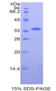 Human PDHB Protein (Recombinant 6His, N-terminus)