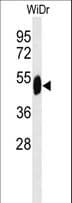 Polyclonal Rabbit anti-Human SETD6 Antibody (aa310-338, IHC, WB)