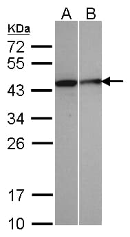 Polyclonal Rabbit anti-Human SEPHS1 / SPS Antibody (aa1-204, IHC, WB)
