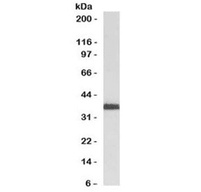 RAD51 / RECA Antibody (clone RALPA-1)