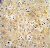 Polyclonal Rabbit anti-Human Apg7 / ATG7 Antibody (aa22-51, IHC, WB)