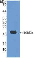 LGALS2 / Galectin 2 Antibody (aa1-130)