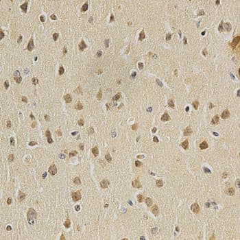 HDAC6 Antibody
