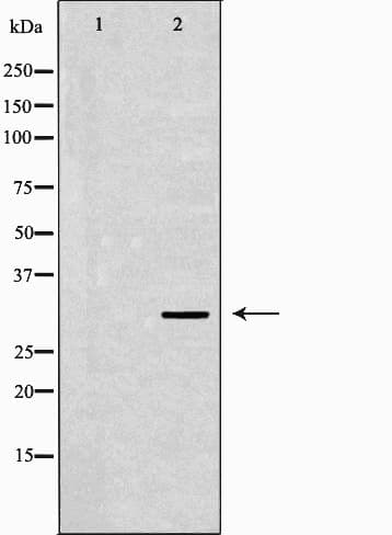IGFBP5 Antibody