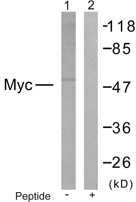Polyclonal Rabbit anti-Human MYC / c-Myc Antibody (p373, IHC, WB)
