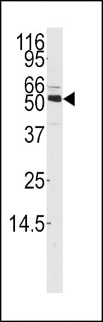 CAMKK1 Antibody (aa337-369)