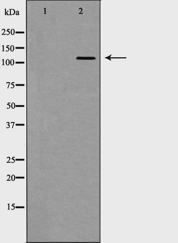 GRM5 / MGLUR5 Antibody
