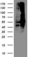 DLD / Diaphorase / E3 Antibody (clone OTI5G7)