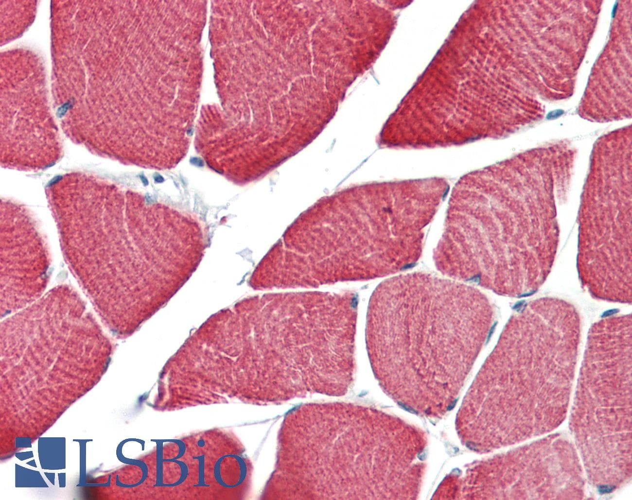 IHC-plus™ TPM2 Antibody