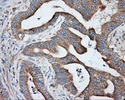 PRKAR2A Antibody (clone OTI1A7, Carrier-free)