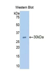 RNASEL / RNase L Antibody (aa358-583, PE)