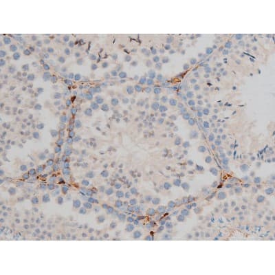 CREB1 / CREB Antibody (phospho-Ser142)