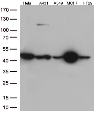KRT18 / CK18 / Cytokeratin 18 Antibody (aa69-372, clone OTI10H8)
