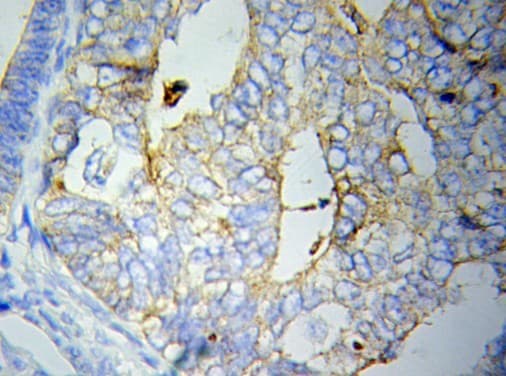 CRP / C-Reactive Protein Antibody