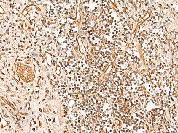 Polyclonal Rabbit anti-Human HUS1 Antibody (IHC)