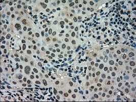 STK39 / SPAK Antibody (clone OTI4E3)