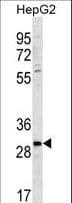 ZDHHC3 Antibody (aa1-30)